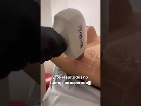 video g9PgKkHVWlw