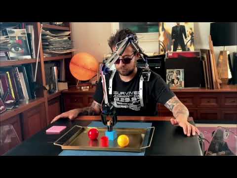 REAL LIFE DOCTOR OCTOPUS ARM!