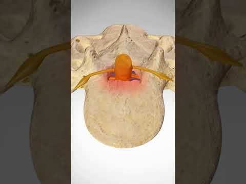 Guess The Spine Injury And Procedure Challenge