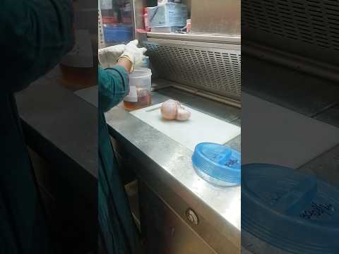 ovary gross pathology | #histopathology #ovary #cyst