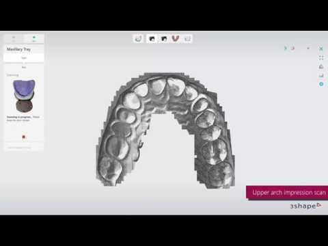 3Shape impression scanning