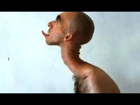 Exercise 5 minuto sa isang araw pagbaba ng timbang Pagkain para sa hypothyroidism Thyroid Diet