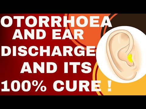 EAR DISCHARGE || OTORRHOEA || BEST HOMEOPATHIC MEDICINE FOR EAR DISCHARGE !