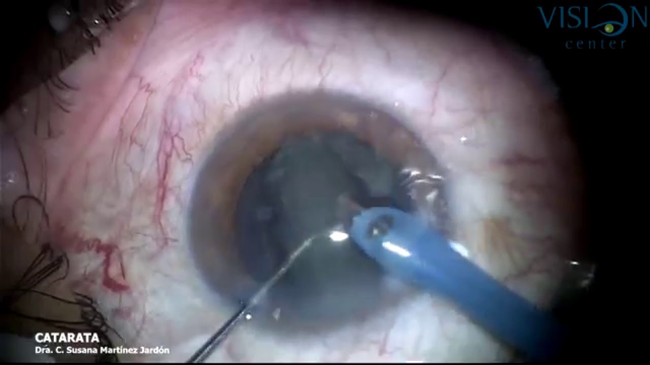 C. Susana Martinez Jardon-25