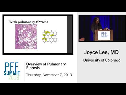 Overview of Pulmonary Fibrosis | Joyce Lee, MD