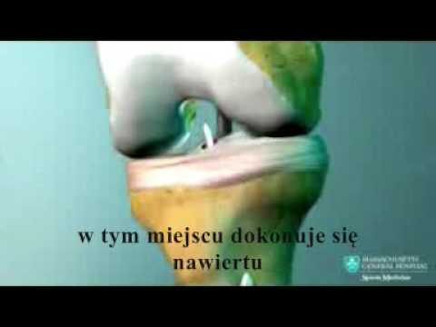 Deformacja palców w postaci pętli przyciski Dzieci masaż stóp podczas koślawego