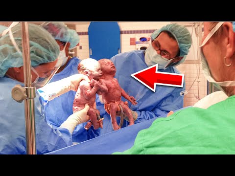A Woman Gave Birth To Semi-Identical Twins, And Doctors Were Left Totally Perplexed