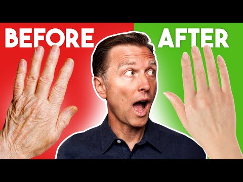 Say Goodbye to Dry, Wrinkled Skin with These Tips!