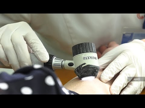 Акция по профилактике рака молочной железы пройдёт 15 апреля в Лоеве видео