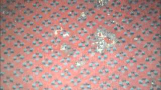 Queens Park Hotel London,filthiest Hotel in the world? Stains,filth and mould,lo