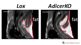 Joslin Scientists Identify Process that Affects Fat Distribution and Metabolic Syndrome