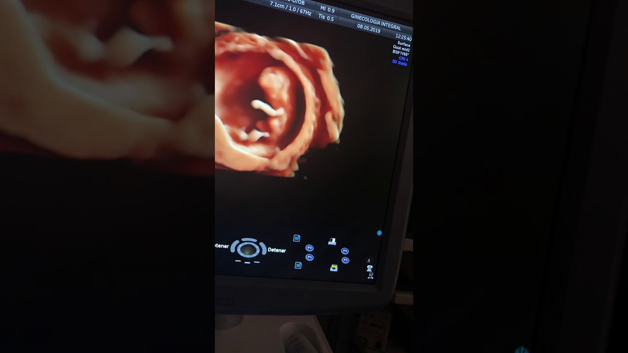 Oscar Alejandro Sánchez Gámez-27