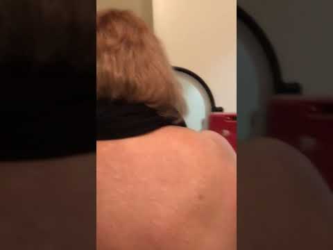 1/17/18 my back red and swollen from frequencies