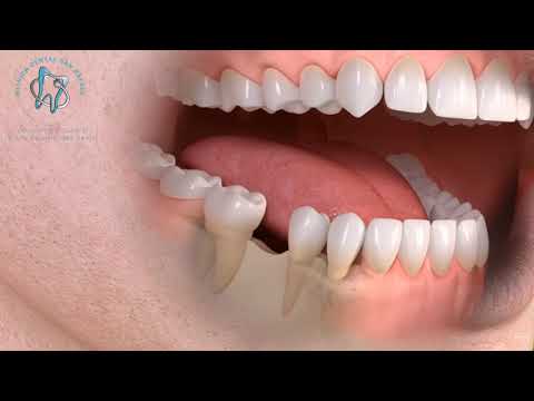 Juan Carlos Franco Miguel-10