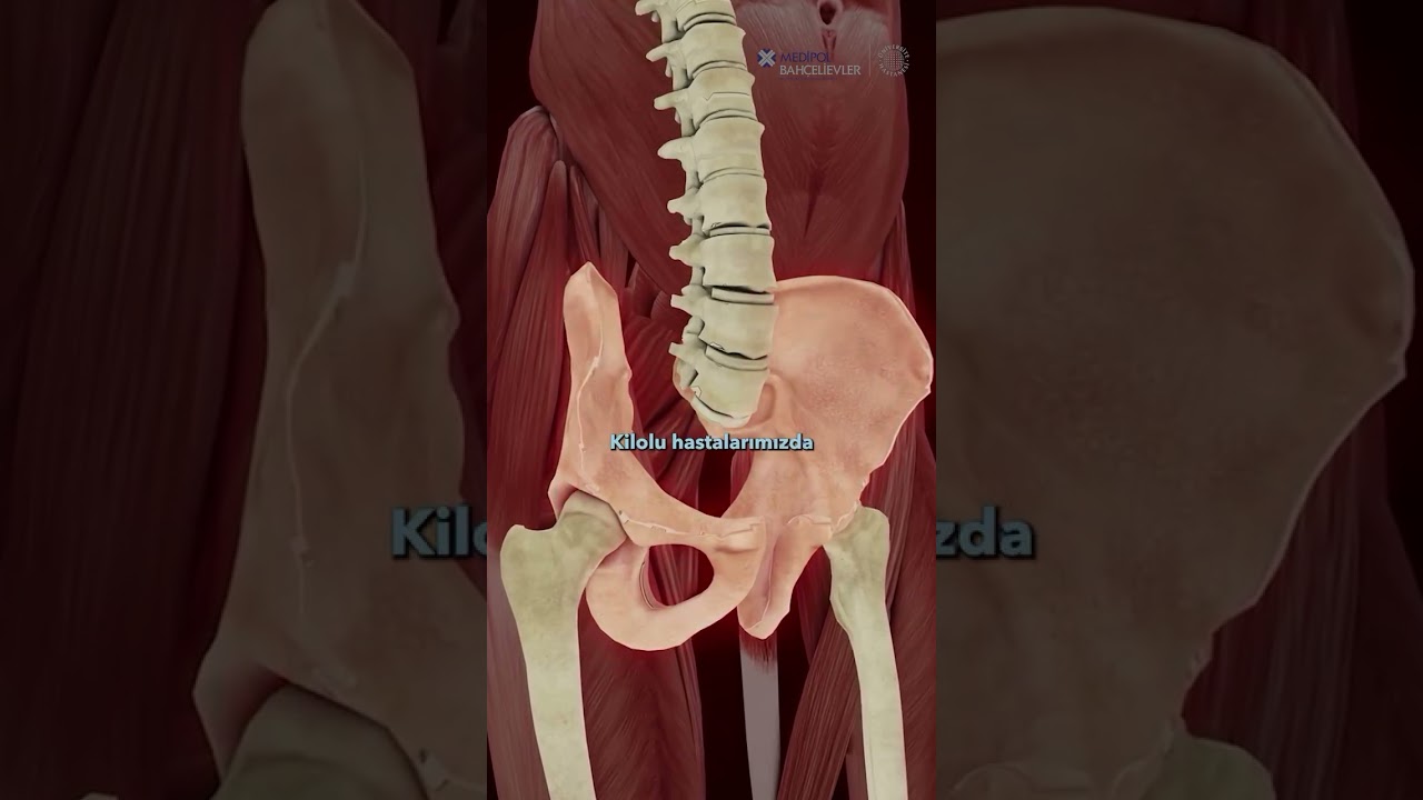 Kadınlarda İdrar Kaçırma Cerrahisi