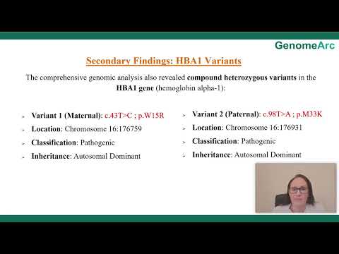 Case 02: Horizon Case Series: de novo KMT2D gene variant and Kabuki Syndrome