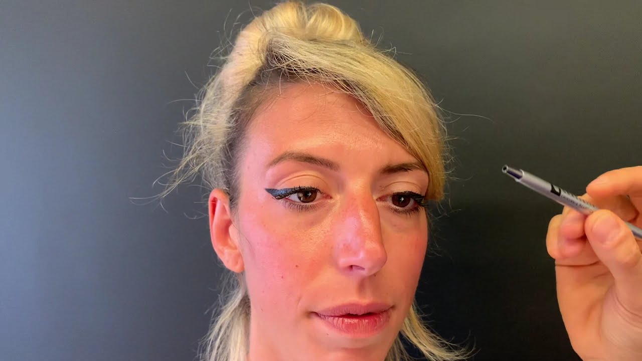 Rinofiller su naso a doppia clessidra