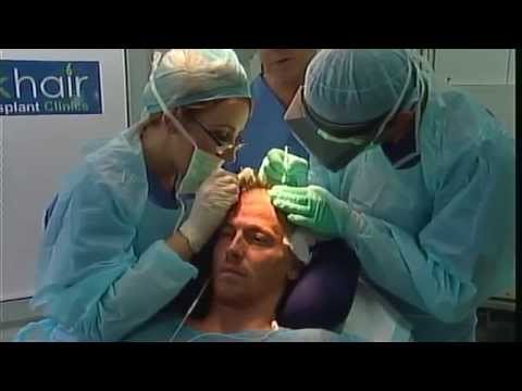 Celebrity Hair Transplant - Joe Swash Hair Transplant Surgery at UK Hair Transplant Clinics