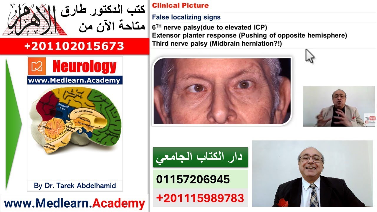 Brain Tumors