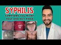 Syphilis Symptoms Treatment Treponema Pallidum Dr David Campos