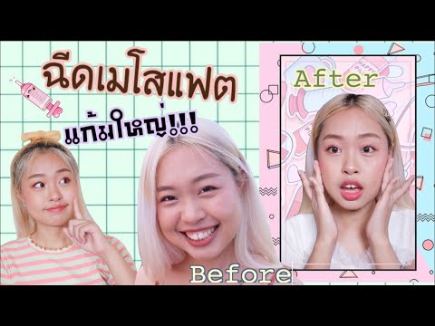 เมโส แฟต