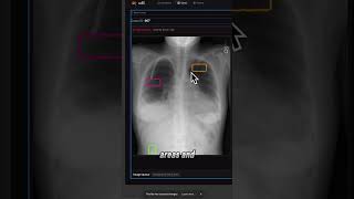 Scanning UX of an AI Radiology SaaS ~ UX Fix #34 ~ Mecha Health #bottomlineux #mechahealth #yc #ux
