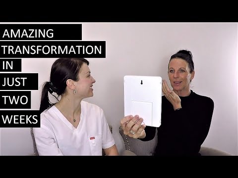 Amazing transformations in just 2 weeks!