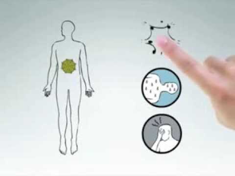 Hepatitis C - HCV Made Simple