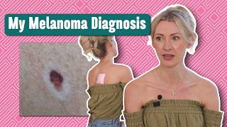 I Have CANCER 🙁 … (The Shocking News No One Wants to Get)