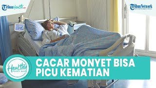 Geger! Munculnya Cacar Monyet Dapat Menular ke Manusia hingga Picu Kematian, Begini Cara Cegahnya