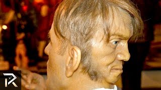 10 Unusual People Born With Extra Body Parts