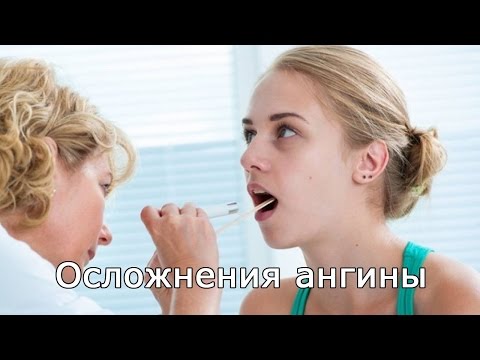 Лечение остеохондроза диска Как лечить грыжу в шейном отделе позвоночника без операции