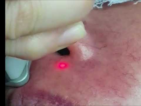 Peduli krim untuk penis Obat-obatan untuk meningkatkan potensi pada pria