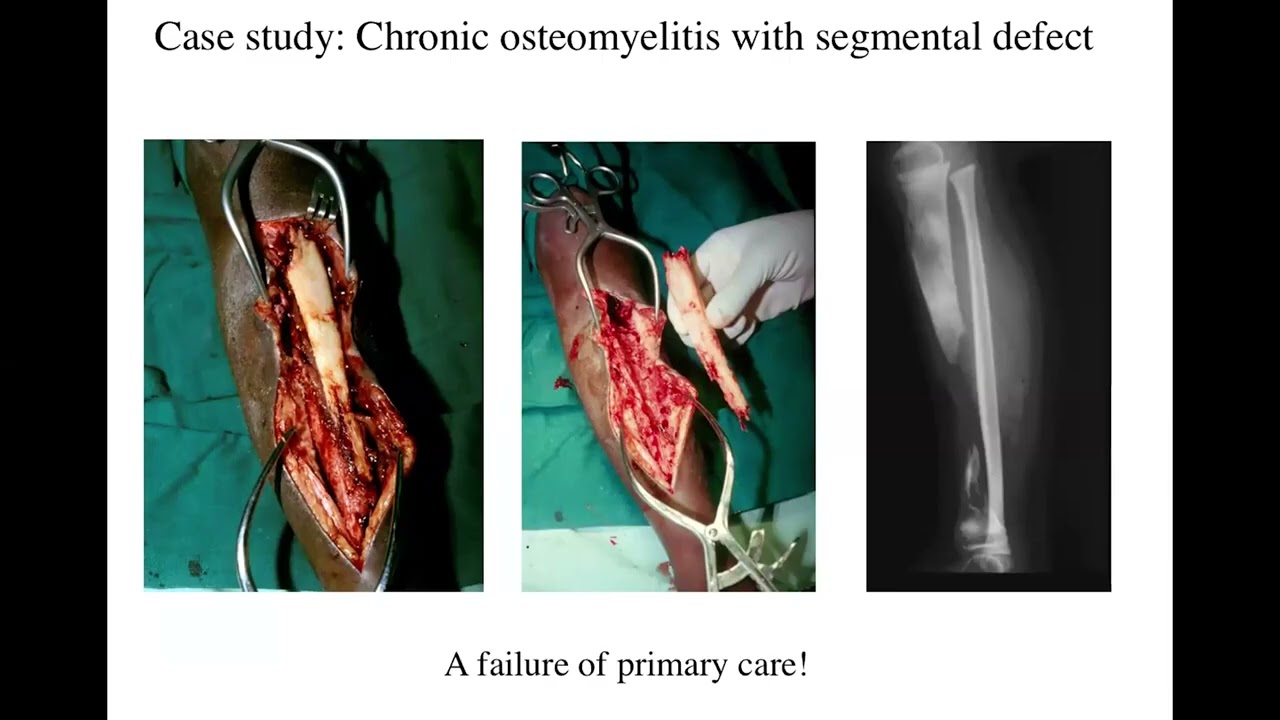 02: What is relevant to teach and to learn? | Norgrove Penny, CM, MD, FRCSC, FCSECSA