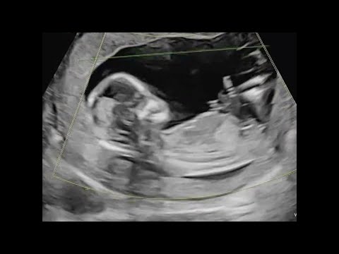 VKL - ลูกหม่ำ [Official MV]