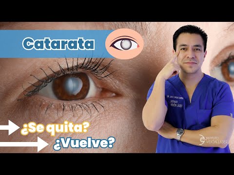 Catarata ¿se quita? ¿vuelve?