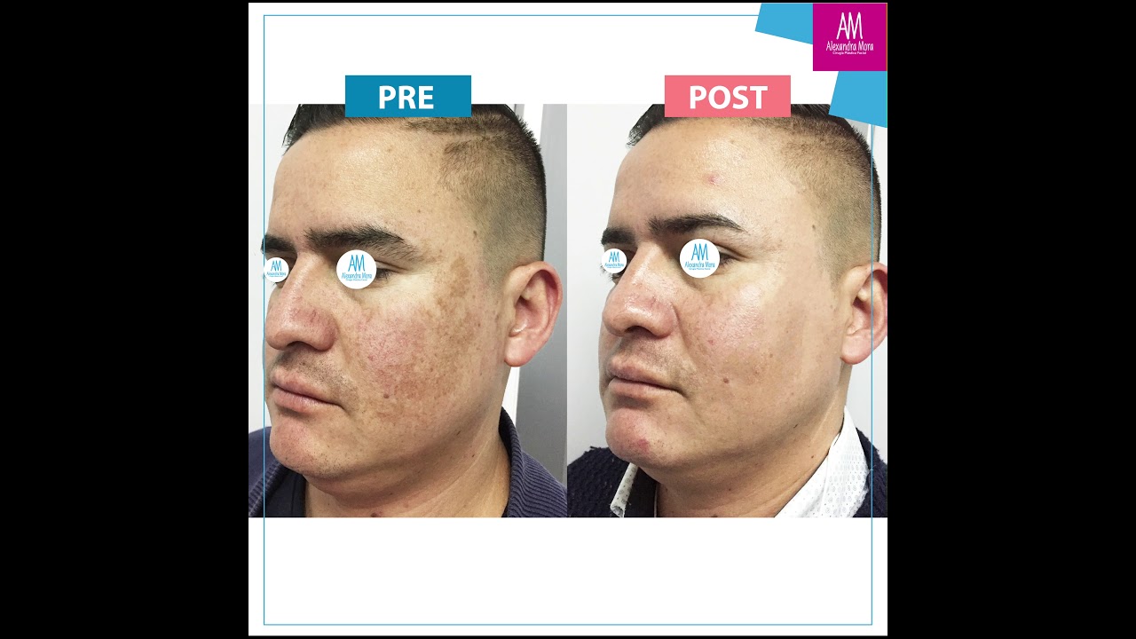 Alexandra Mora Hernandez-163