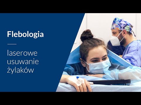 Laserowe usuwanie żylaków u młodych osób