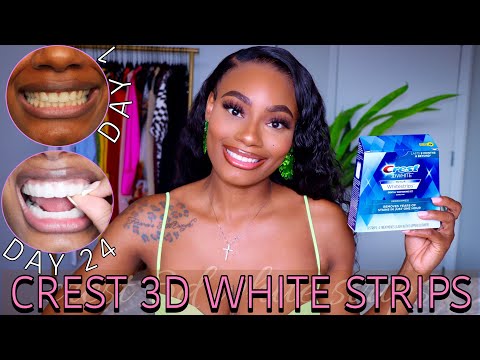 I Tried The Crest 3D White Strips for 24 Days! | Quick/Affordable Teeth Whitening | Before & After