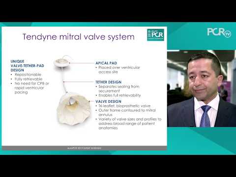 Tendyne transcatheter mitral valve implantation - EuroPCR 2019