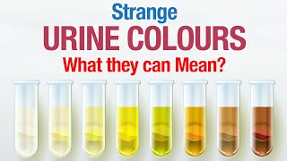 Strange Urine Colours - And What They Mean?