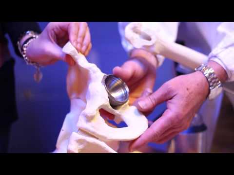 Dolore acuto del trattamento spalla Un costo di protesi danca di ceramica