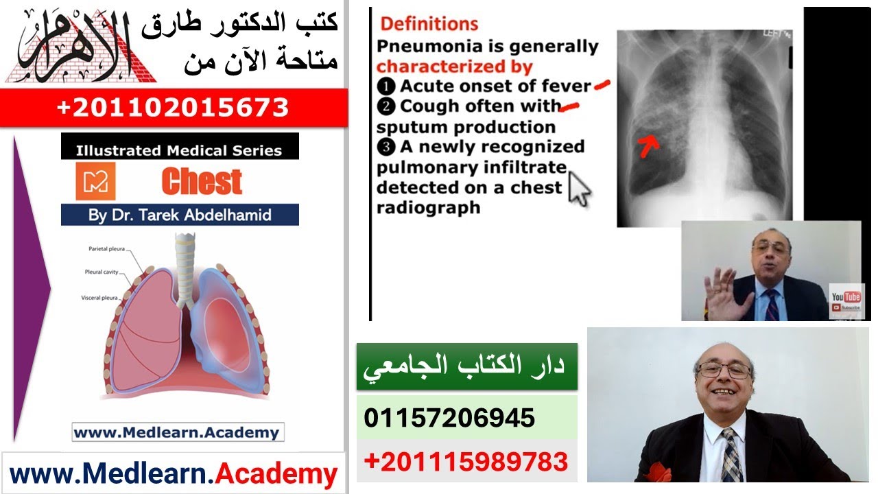 Pneumonia (Extra Points) [A]  #cme #internal_medicine #medical #usmle #محاضرات_باطنة