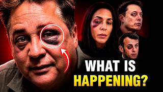 MORE CELEBRITIES HAVE BLACK EYES... Could It Be a Pact?