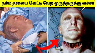 முடியாததை முடித்துக்காட்டிய மருத்துவர்கள் #2 | Medical Miracles | Tamil Amazing Facts | Transplant