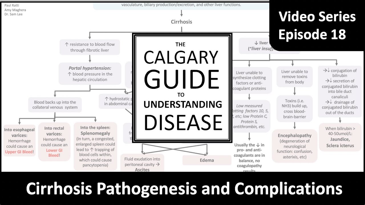 Cirrhosis: Pathogenesis and Complications