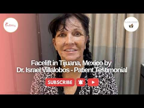 Turn Back Time with a Facelift in Tijuana, Mexico by Dr. Israel Villalobos