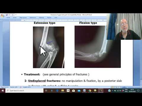 Orthopedic in Arabic 16  , ( Supracondylar fracture, part 2 ) , by Dr. Wahdan