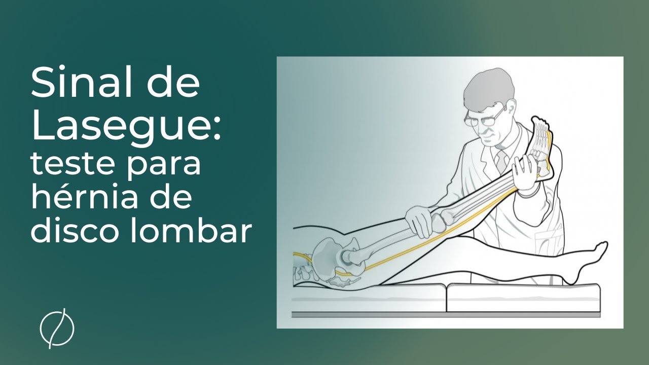 Sinal de Lasegue: teste para hérnia de disco lombar