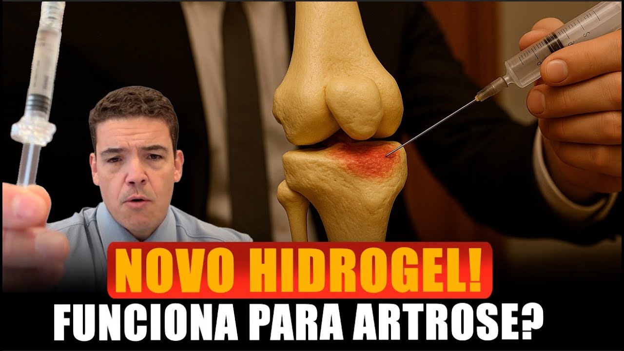 CHONDROPATHIES AND ARTHROSIS: DOES THE NEW HYDROGEL WORK? 🤔